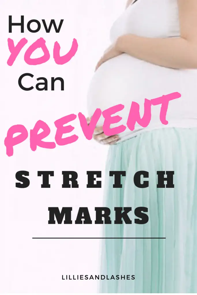 Best-Ways-To- Prevent-Stretch-Marks-While-Pregnant #StretchMarks #PreventStretchMarks #PregnancyStretchMarks